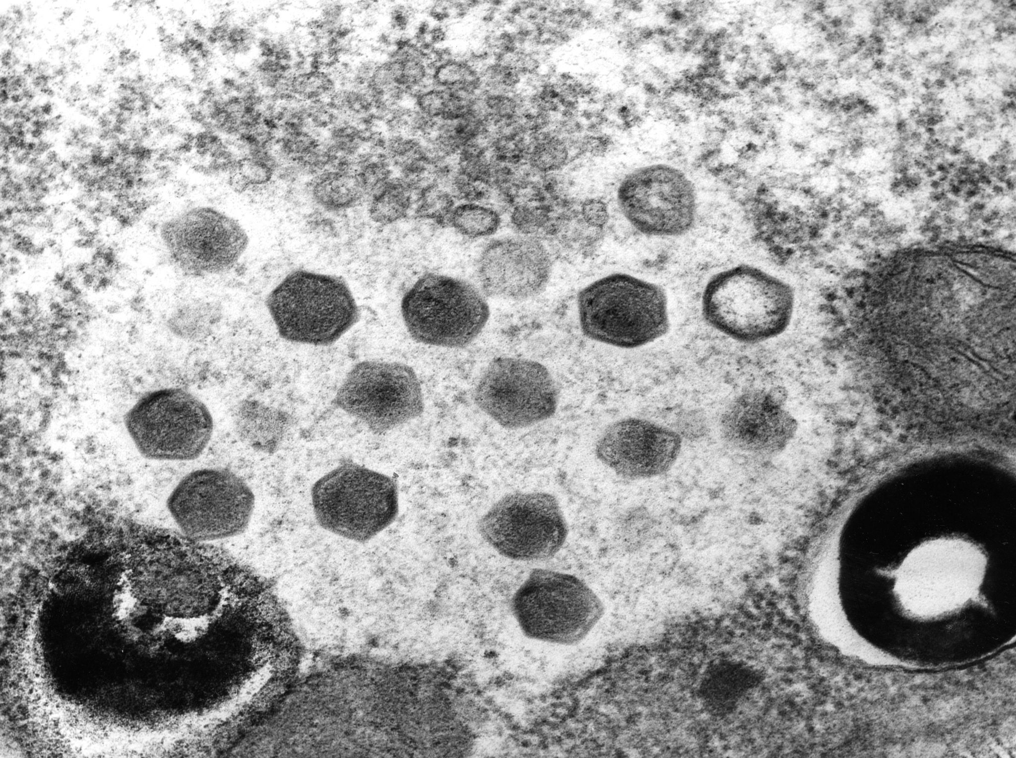 Protein Channelrhodopsins - Technion - Israel Institute of Technology