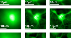 3. In the image table: images of neurons that were captured by the system. On the left: a regular image of a neuron deep within the tissue. In the middle: the dramatic improvement provided by the new technology. On the right: a real image of the neuron taken without scattering tissue.