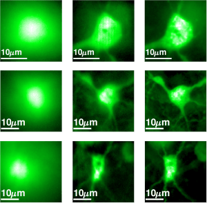 3.In the image table: images of neurons that were captured by the system. On the left: a regular image of a neuron deep within the tissue. In the middle: the dramatic improvement provided by the new technology. On the right: a real image of the neuron taken without scattering tissue.