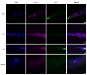 תמונה פלורוסנטית זו מתארת הימצאות סלקטיבית של החלבון ADR-2 בתולעת C.elegans באזורי הראש, הגוף, הזנב והזרעונים. משמאל לימין: הצבע הכחול מייצג את הדנ"א שנמצא בתאי התולעת באזורים השונים (DAPI) ונועד לסמן את כל התאים הקיימים באזור, ואילו הצבע הסגול מייצג נוכחות של החלבון ADR-2 (ADR-2) בתאים. הצבע הירוק מייצג את מיקום תאי אפיתל בתולעת (MH27). איחוד של שלושת הצבעים (merge) מראה כי החלבון ADR-2 מתבטא רק בחלק מהתאים הנמצאים בראש, בגוף, ובזנב. לעומת זאת, בזרעונים אין כלל נוכחות ADR-2. בתמונות ה-merge רואים כי תאים שיש בהם את החלבון ADR-2 הם בעלי צבע סגלגל (הנובע משילוב הצבע הכחול של הדנ"א והצבע הסגול של ADR-2) ואילו תאים שאין בהם ADR-2 בעלי צבע כחול ומסומנים על-ידי חץ אדום.